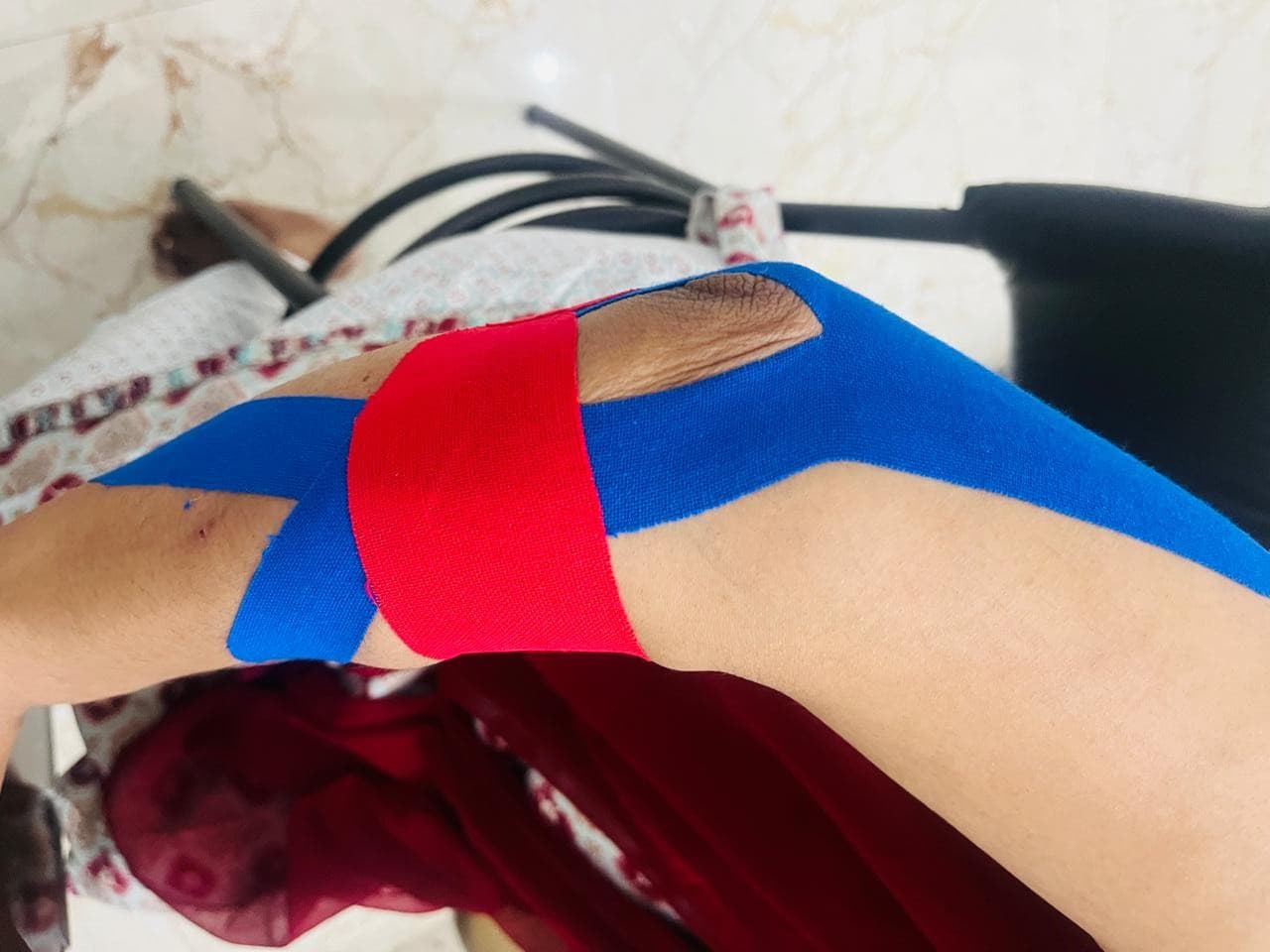 Tennis / Golfer's Elbow